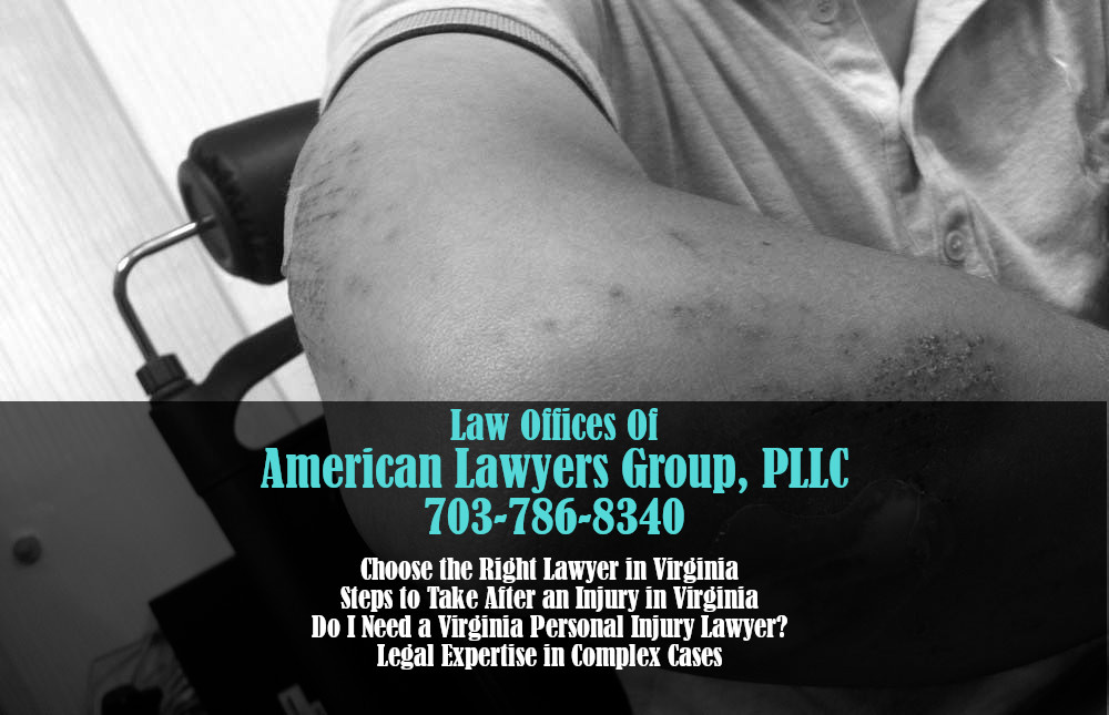 Personal Injury Claim in Virginia