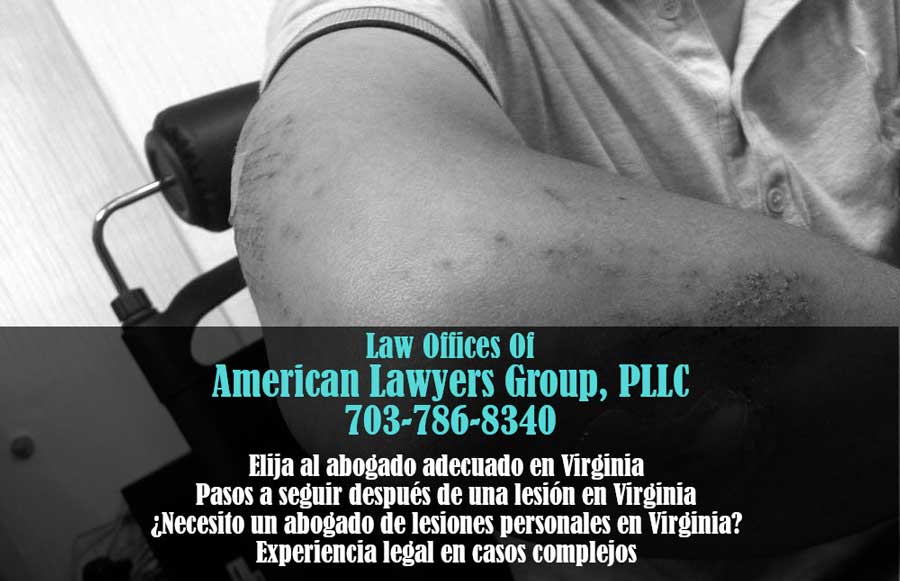 Reclamación por lesiones personales en Virginia